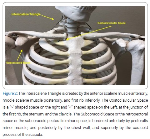 Historic Basis for the New Developments in the Diagnosis and Treatment of  Thoracic Outlet Syndrome (TOS) - Clinical Surgery Journal (ISSN 2767-0023)
